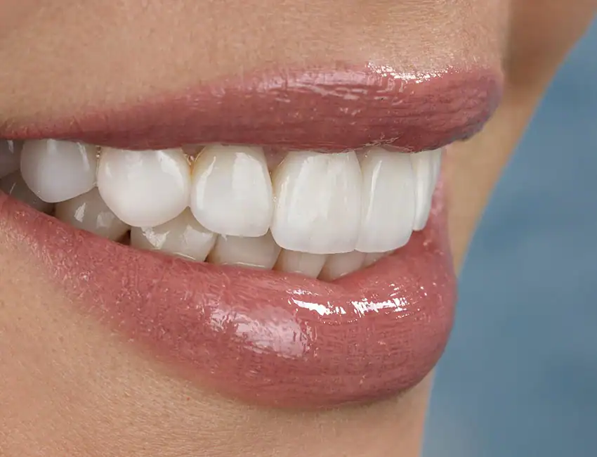 Patient's healthy and stunning smile in Camarillo, CA