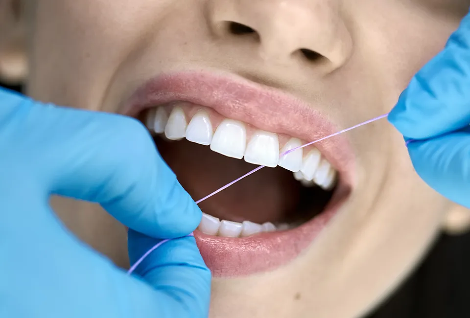 Dental Cleaning