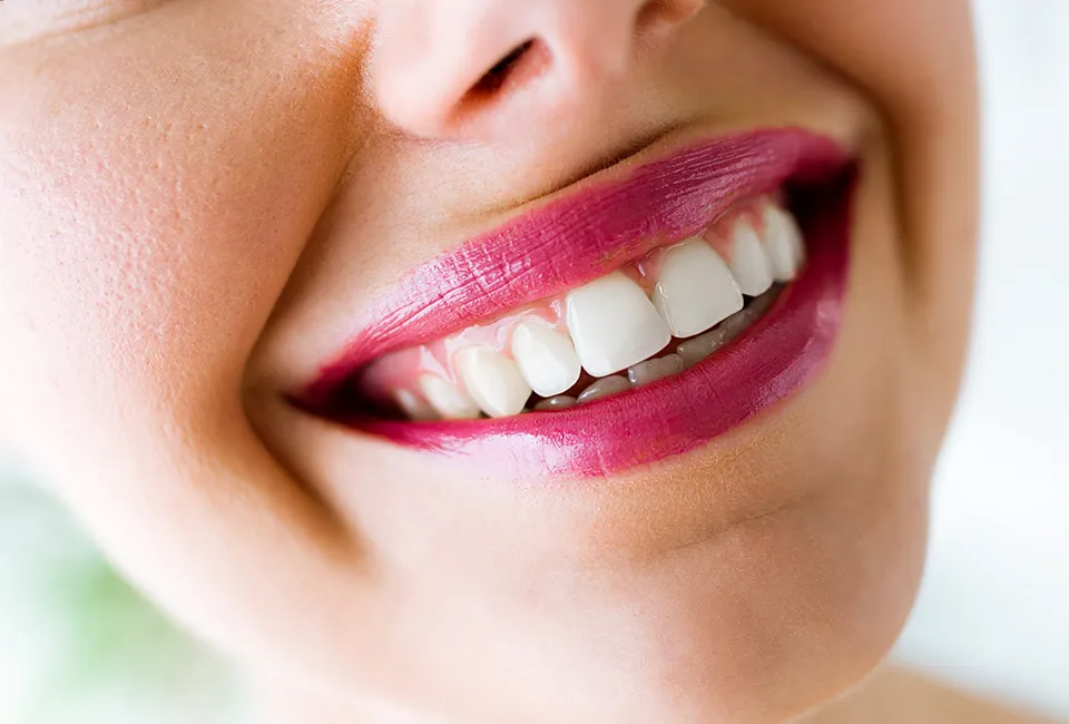 great-smile treatment timeline for Invisalign aligners
