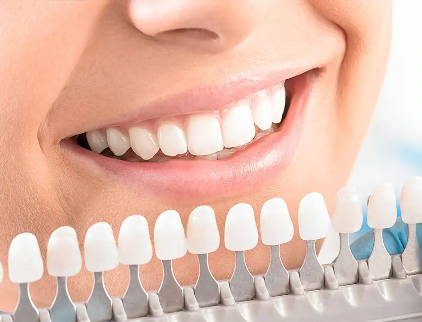 professional Zoom teeth whitening