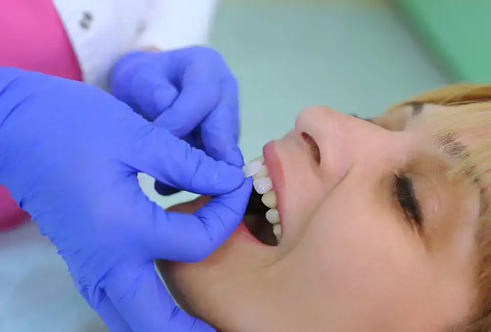 veneerds-treatment-dental (1) how long do porcelain veneers last